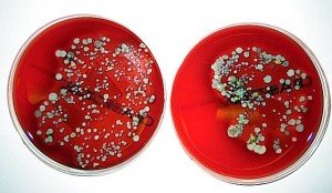 petri dishes