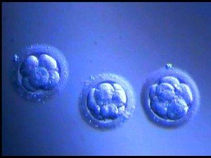 IVF_embryos