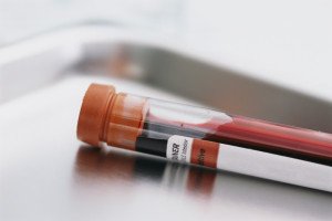 Blood Sample