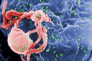 Scanning electron micrograph of HIV-1, colored green, budding from a cultured lymphocyte. Credit: C. Goldsmith/CDC