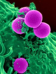 Scanning electron micrograph of MRSA (credit: Flickr / NIAID)