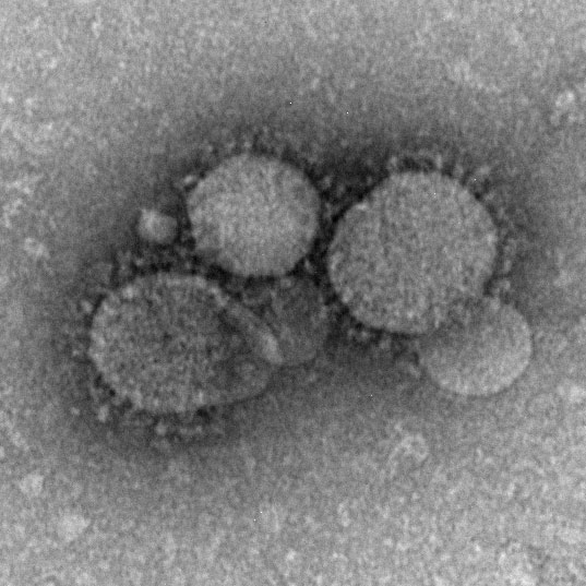 MERS-CoV_electron_micrograph1