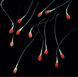 Sperm-20051108