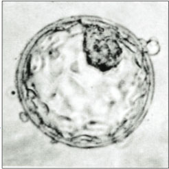 Human_blastocyst