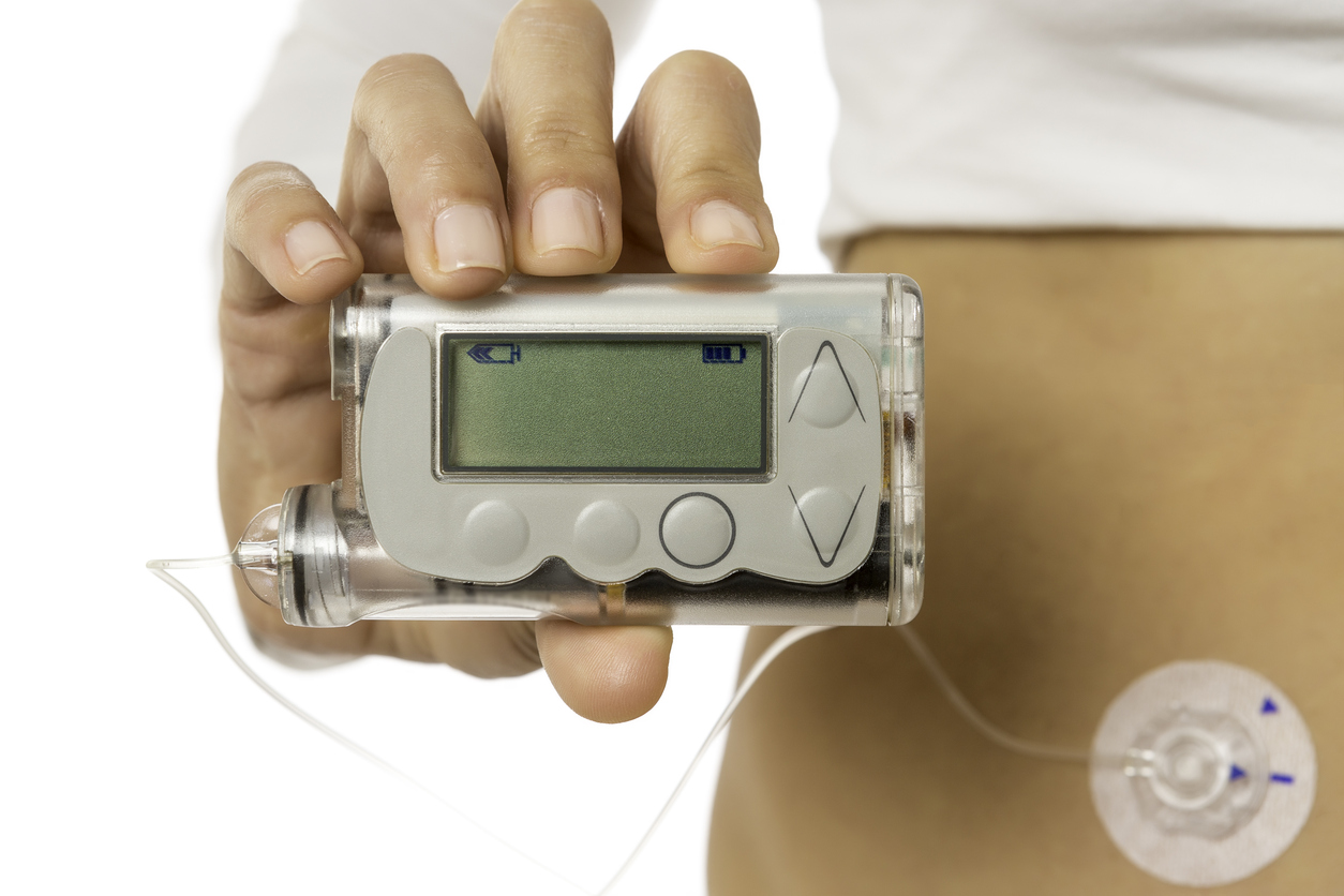 Artificial pancreas