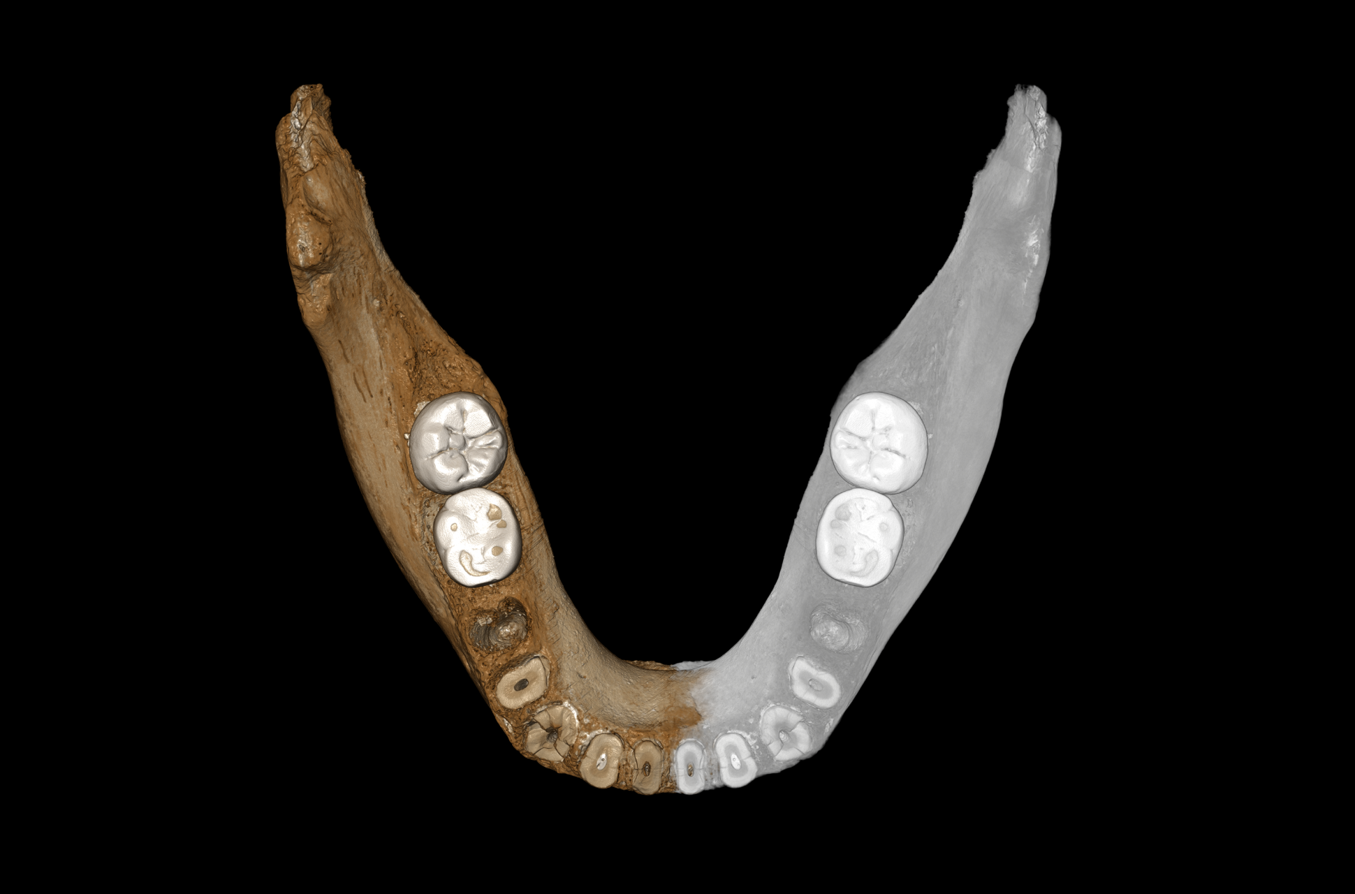 Denisovan jawbone discovery – Expert Reaction