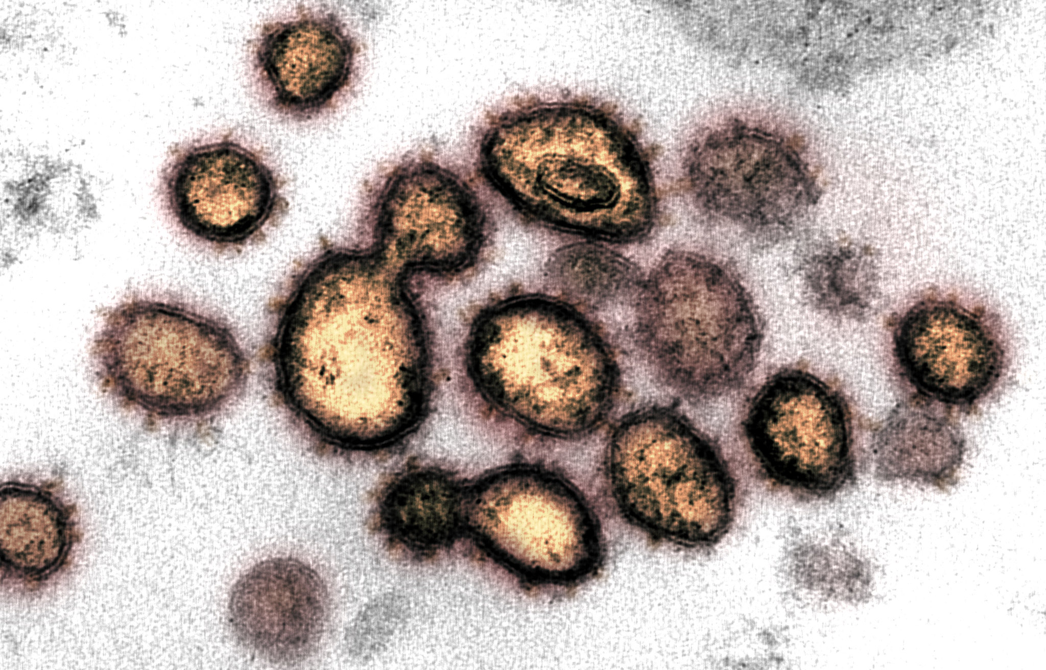 New coronavirus variant spreading in Britain – UK SMC Expert Reaction